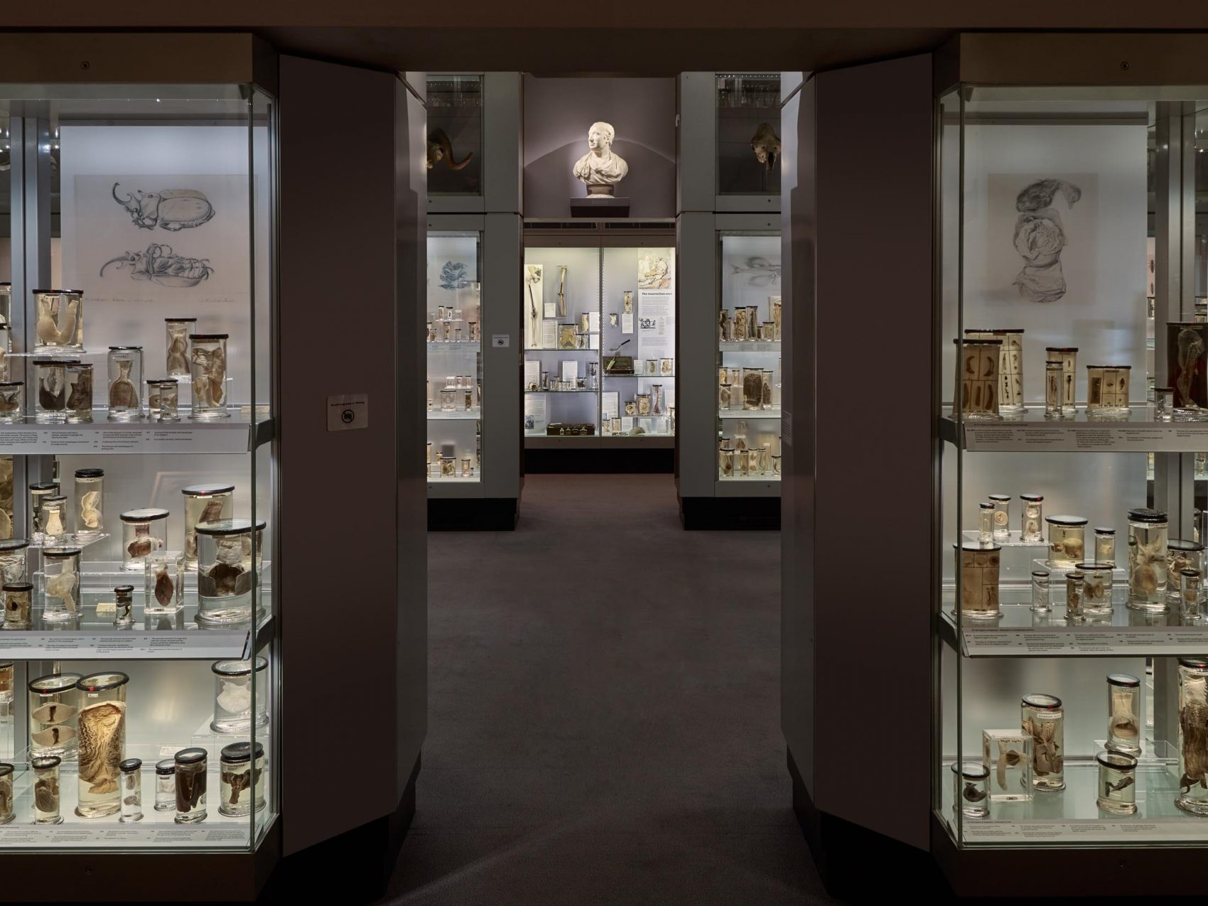 Obscure London Museums - Hunterian